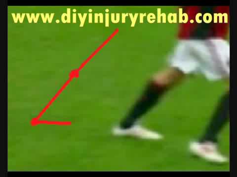 how to snap achilles tendon