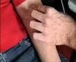 Self Hypnosis - Pain Control Self Anaesthesia