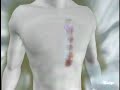 Trauma Center: SO Extream Speedrun 18m57s part1/2 Trauma Center: SO Extream Speedrun 18m57s part1/2