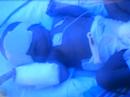 Trinitas NICU