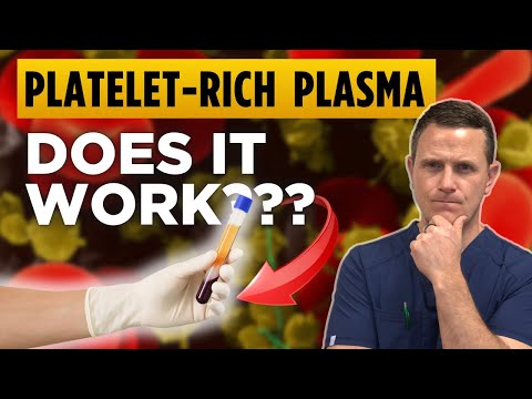 The TRUTH about PRP for Joint Pain: Does It Really Work?