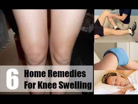 how to reduce knee swelling