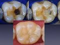 Uso clinico materiales dentales