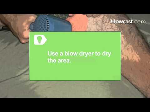 how to cure groin itch