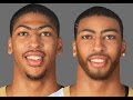 Anthony Davis Extreme Makeover Photoshop