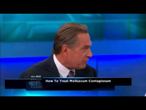 how to cure molluscum contagiosum