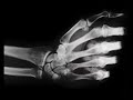 XRAY Coin Magic Trick for the iPod / iPhone