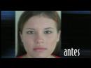 Sistema De Tratamiento Organico Del Acne