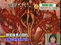 マルチスライスCTを使用した人間ドックの紹介コーナー