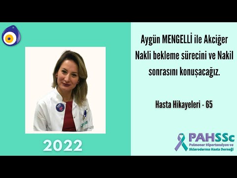 Hasta Hikayeleri - Aygün MENGELLİ ile Akciğer Nakli Bekleme Süreci ve Nakli Sonrası - 65 - 2022.09.13