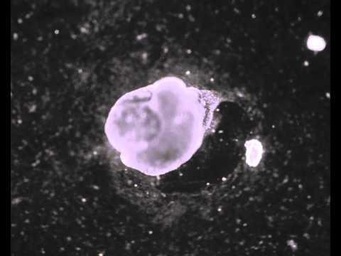 how to isolate calcium