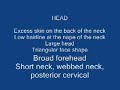 Noonan syndrome and Autism momto2miracles Noonan syndrome and Autism momto2miracles