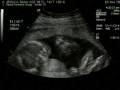 videos de sonogram