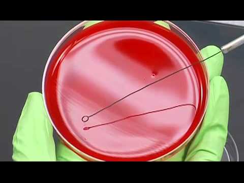 how to isolate streptococcus mutans