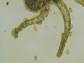 Trichodina 2