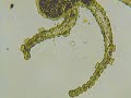 Trichodina 2