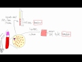 Anemia:  Basic lab tests - hematocrit, hemoglobin, reticulocyte, MCV, morphology