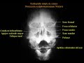 anatomia radiologica  en radiologia simple