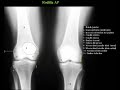 ANATOMIA RADIOLOGICA  EN RADIOLOGIA SIMPLE