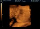 Francisco Jose Moyano Francisco Jose Moyano