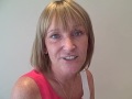 Angela Brown Restylane treament