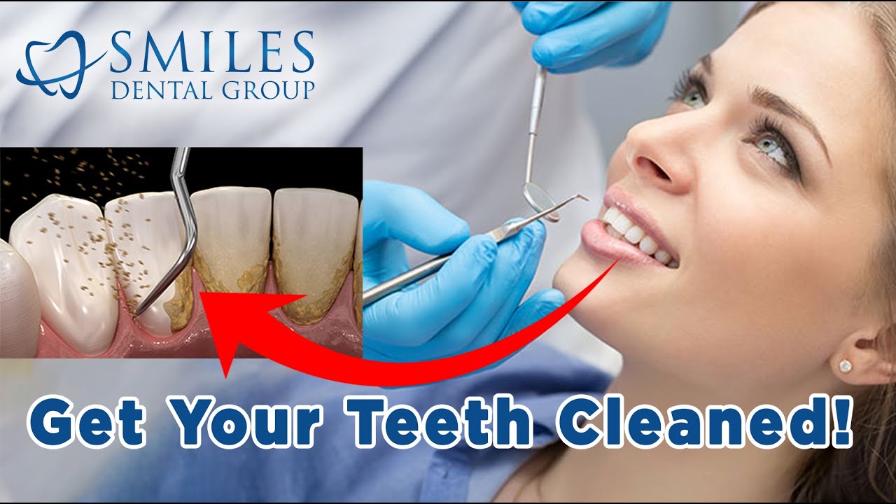 Why You Need To Get Your Teeth Cleaned by a Dental Hygienist And What Happens If You Don’t?