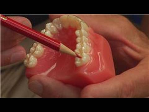 how to drain swollen gums