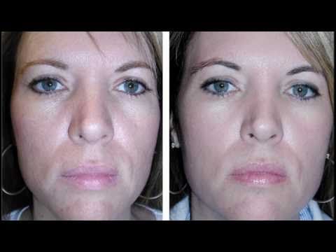 how to avoid wrinkles