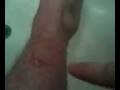hydrogen..PEROXIDE!