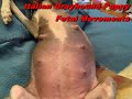Fetal Movements
