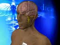 On average, another person is diagnosed with multiple sclerosis every hour in the US MS is a devastating disease that can slowly rob patients of everything from their sight to control of their muscles. Doctors aren't sure what causes it, but they're finding better ways to tame it. They're placing electronic probes in the brain -- and giving some desperate patients relief.