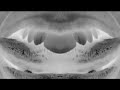 Acid Trip One