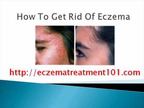 how to eliminate eczema without the use of medication