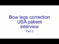 Bow Legs Correction - USA Patient Interview - Part 2