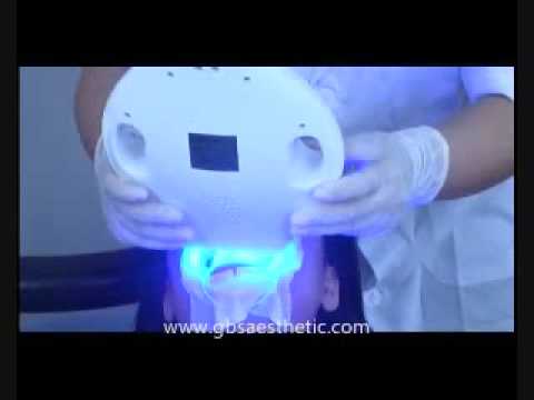 how to whiten teeth with a uv light