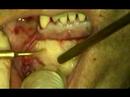 Dental Implant Video preview 06