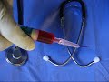 Lighter than air local anesthetic !