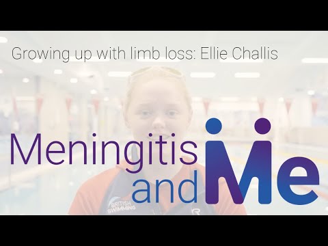 Ellie Challis: Growing up with limb loss