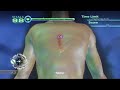 Trauma Center: NEW BLOOD Extream Speedrun 12m47s part 2/2 Trauma Center: NEW BLOOD Extream Speedrun 12m47s part 2/2