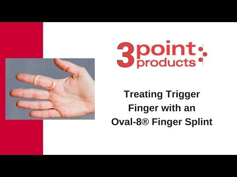 how to relieve trigger finger