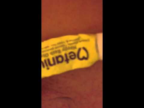 how to cure jock rash