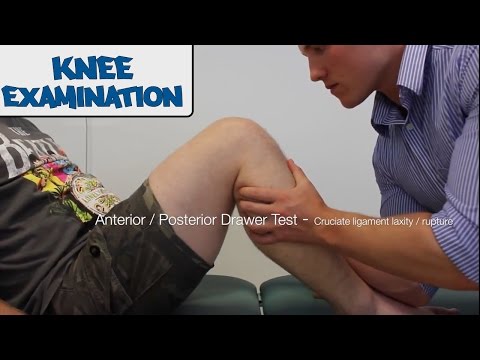 how to exam a knee