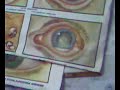 Ophthalmology Practice(Eyelid margin 1) Ophthalmology Practice(Eyelid margin 1)