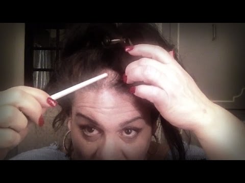 how to cover a bald patch on your head