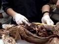 CSUN - Anatomy: digestive, respiratory, and urinary
