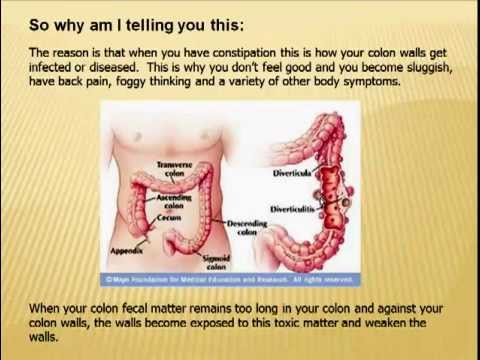 how to relieve everyday constipation