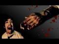 BFX: Blood Filled Fake Hand