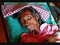 an-interview-regarding-the-origin-of-aids-pt-3.html