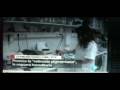 Descubren el gen causante de la Retinosis Pigmentaria (EYS)