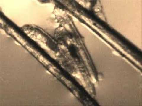 how to treat d. folliculorum